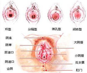 外阴性不孕的的图例解析