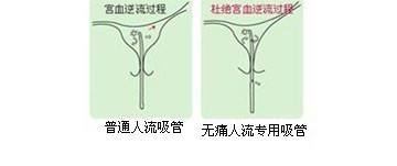 永州哪家医院做流产好?