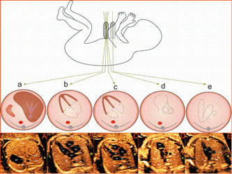 胎儿超声心动图_永州现代妇儿医院